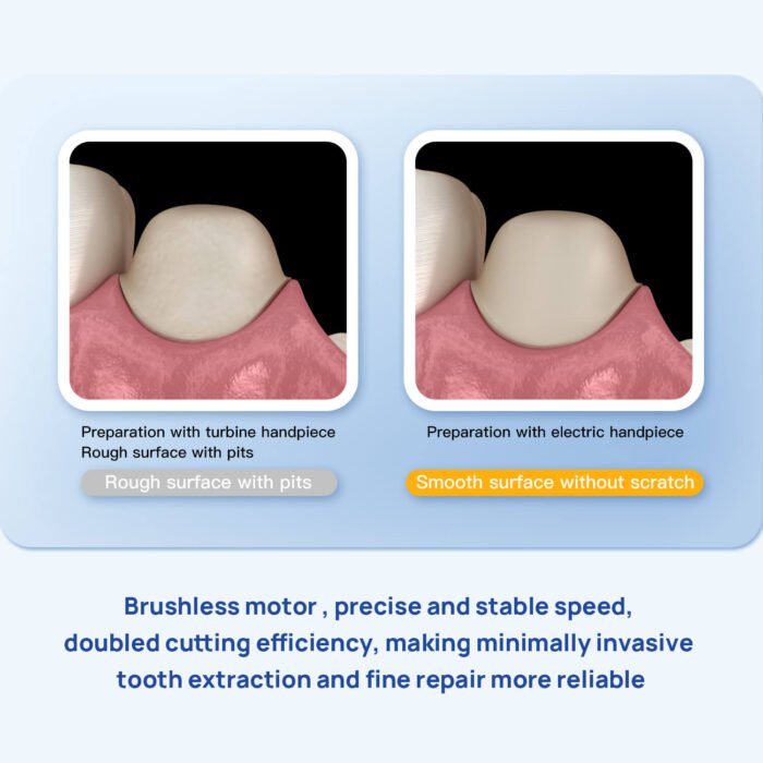 Dental LED Electric Brushless Surgery Motor System Touch Screen with Water Supply - Image 7